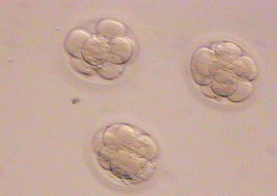 Embrioni